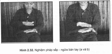 Nghiệm pháp sấp