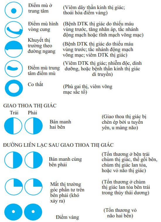 Các tổn hại thị trường 